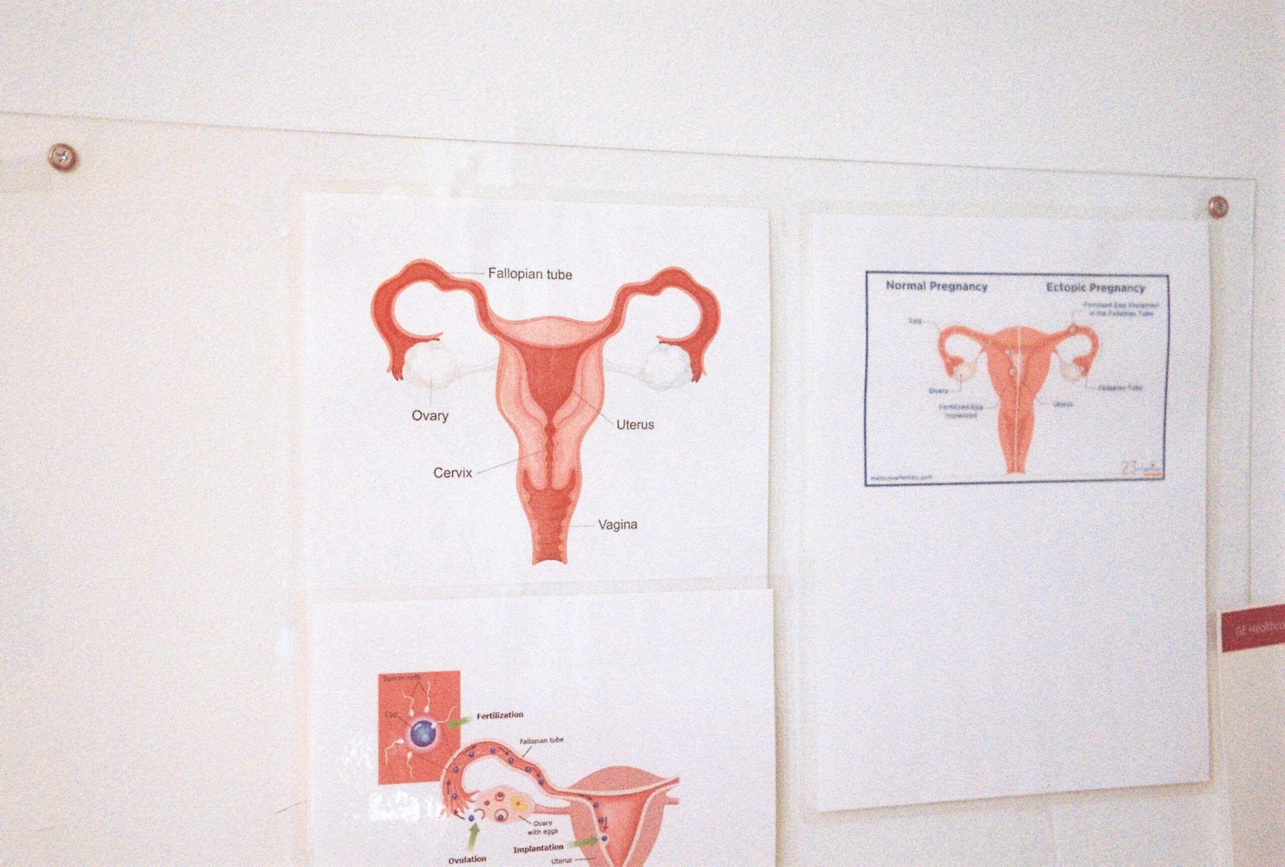 Carmen Winant, Preterm (Cleveland, Ohio), from “The Last Safe Abortion,” 2024, Photography courtesy of the artist